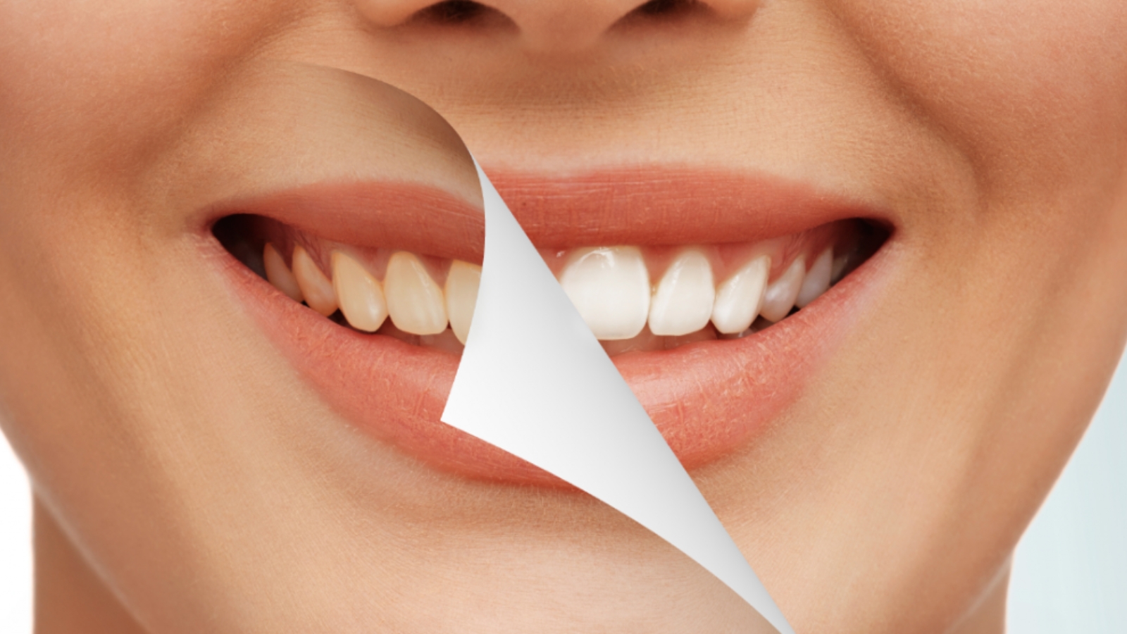 how cosmetic dentistry will enhance your smile