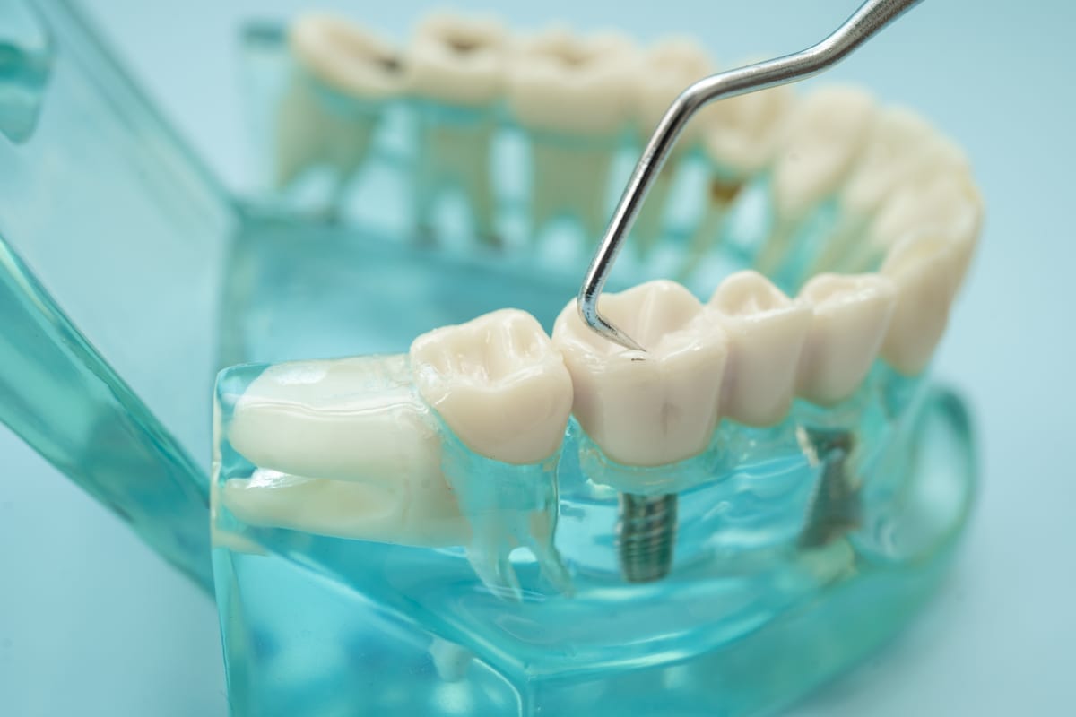 Restorative Dentistry in Greeley